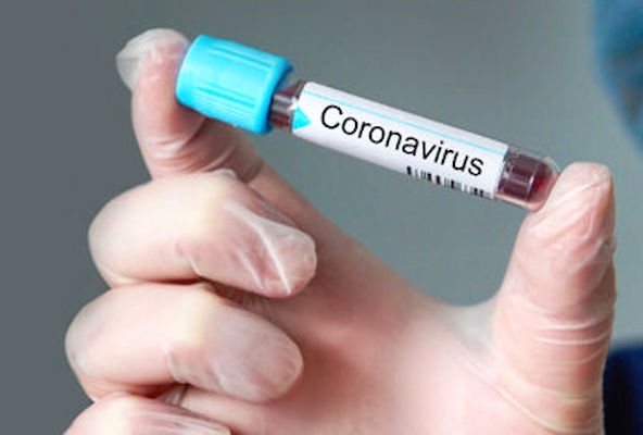 6 Fahrer sind positiv auf Coronavirus in den Arabischen Emiraten getestet